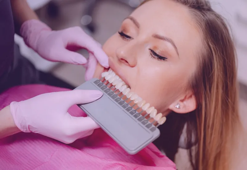 Guía de colores dental comparada con los dientes de una paciente durante una valoración de blanqueamiento dental