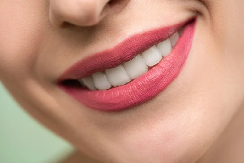 Sonrisa perfecta con dientes blancos y alineados - Estética dental en Legazpi